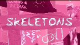 Miniatura del video Skeletons